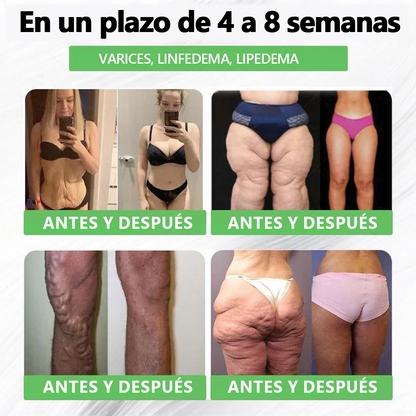 Tienda Oficial🏥𝗘𝗤𝗩𝗣® 𝐺𝐿𝑃-𝟏 Solución de Salud Seis-en-Uno en Líquido Oral(Resultados visibles en 7 días)✅ Adecuado para la obesidad, la salud cardiovascular, la diabetes, la salud intestinal, los problemas de articulaciones y mucho más.
