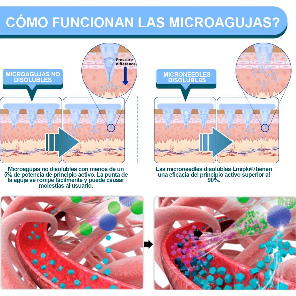 Tienda oficial📢Lmipki® Parche de Microagujas Nano NIDDK-Tirzepatide☑️Aprobado por COFEPRIS (Sin dolor, de larga duración, aborda la diabetes, la obesidad y las enfermedades cardiovasculares)🇲🇽Resultados en 7 días